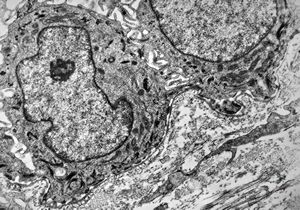 F,23y. | normal oral mucosal epithelium F,23y. | normal oral mucosal epithelium